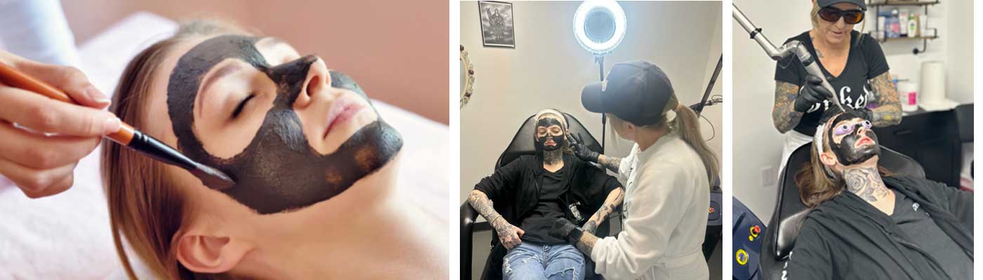 Skin Rejuventaion with Carbon Fiber mask Manatee County