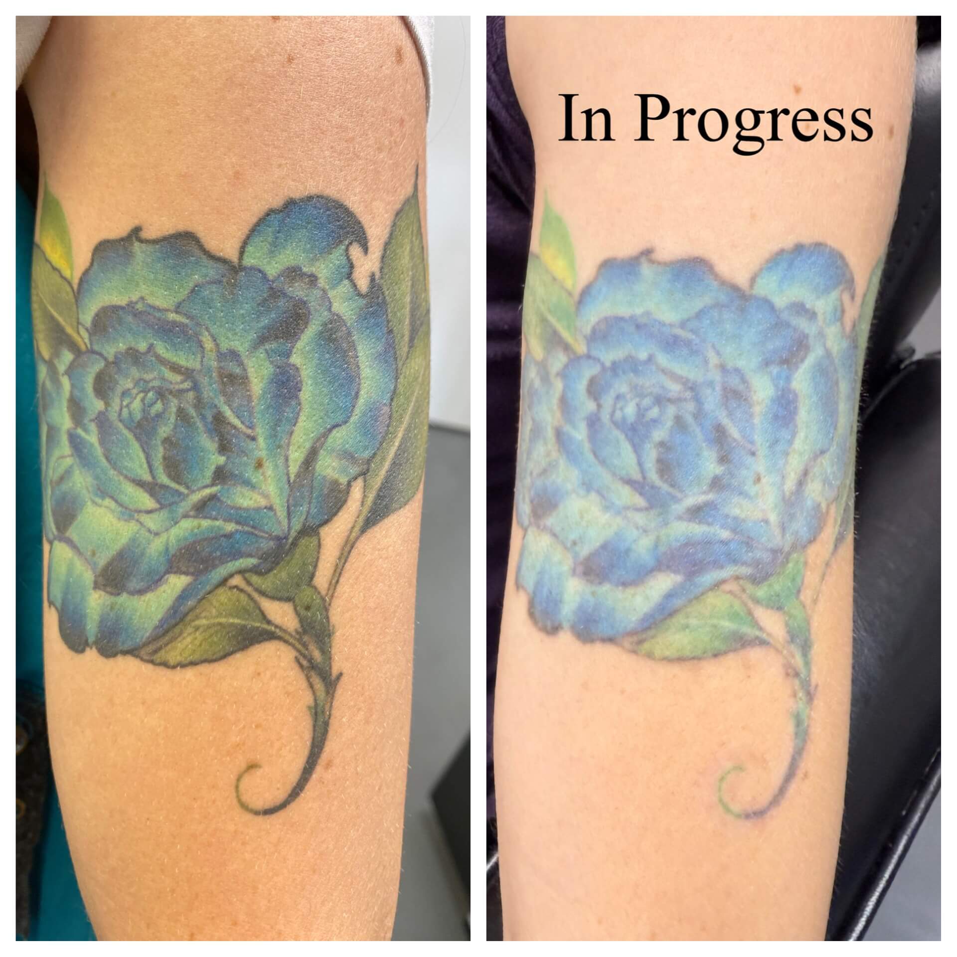  Tattoo removal services serving Sarasota County
